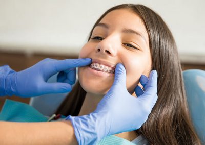 Apparecchio per i denti: cosa c’è da sapere